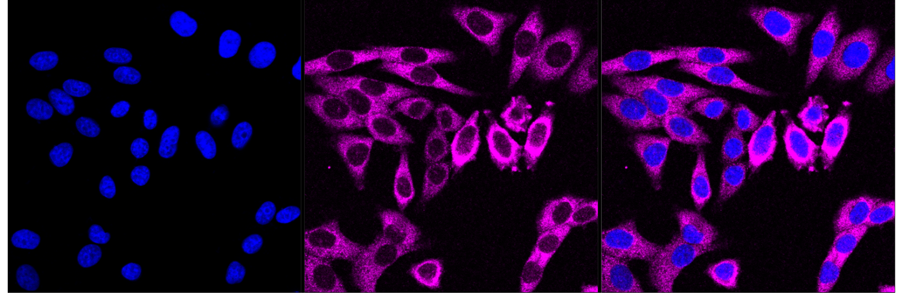 [KD Validated] Anti-EIF2AK2 Mouse mAb [72R20N66]