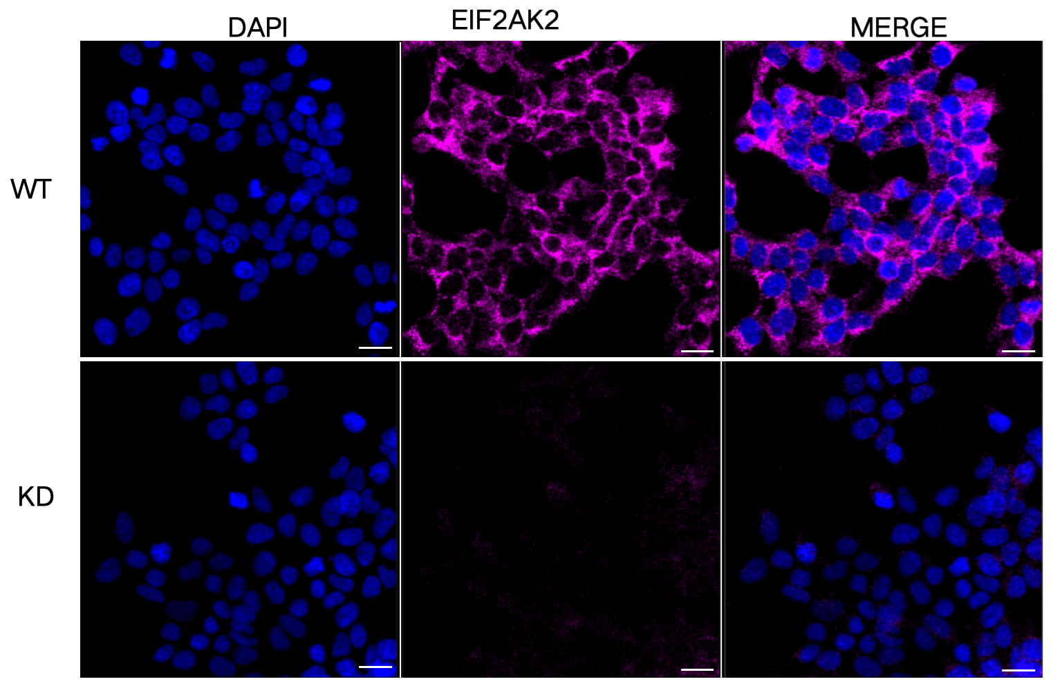 [KD Validated] Anti-EIF2AK2 Mouse mAb [72R20N66]