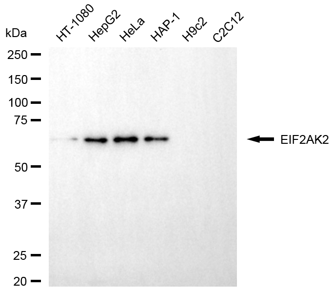 [KD Validated] Anti-EIF2AK2 Mouse mAb [72R20N66]