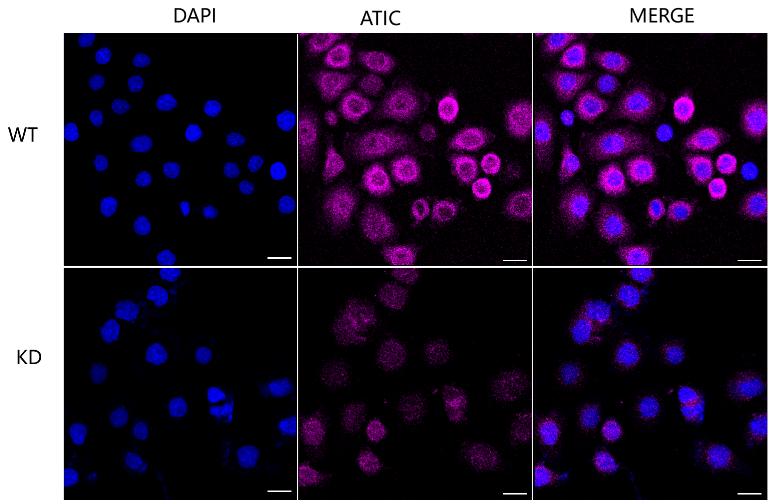 [KD Validated] Anti-ATIC Mouse mAb [76C67S93]