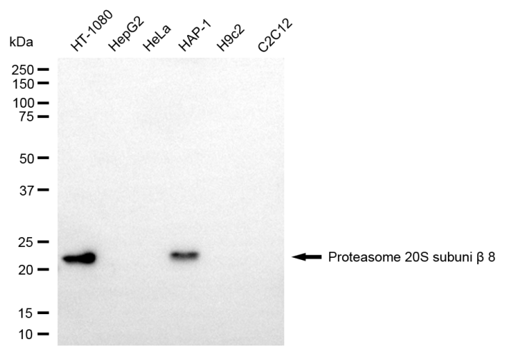 [KD Validated] Anti-PSMB8 Mouse mAb [98L19Q68]