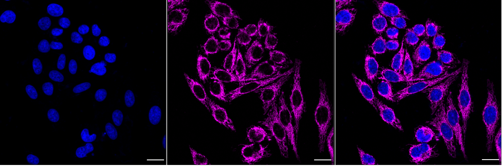 [KD Validated] Anti-ETFA Mouse mAb [39G69K42]
