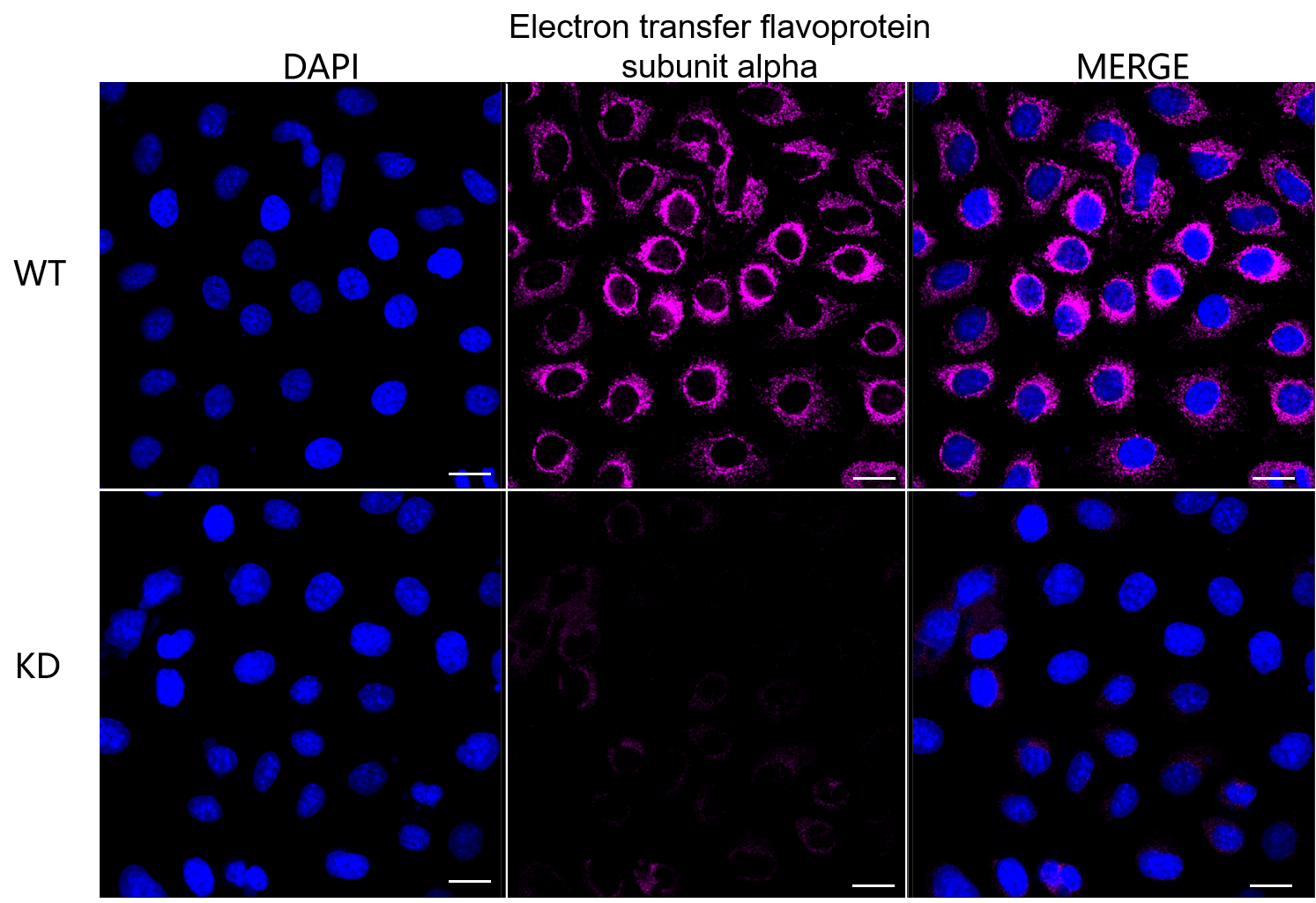 [KD Validated] Anti-ETFA Mouse mAb [39G69K42]