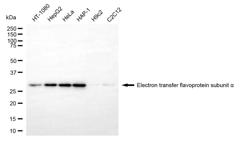 [KD Validated] Anti-ETFA Mouse mAb [39G69K42]