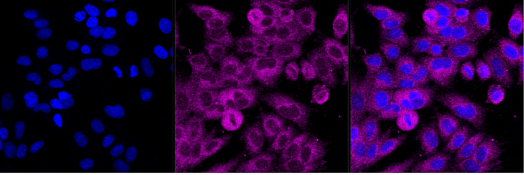 [KD Validated] Anti-ASCC2 Mouse mAb [99D98O98]
