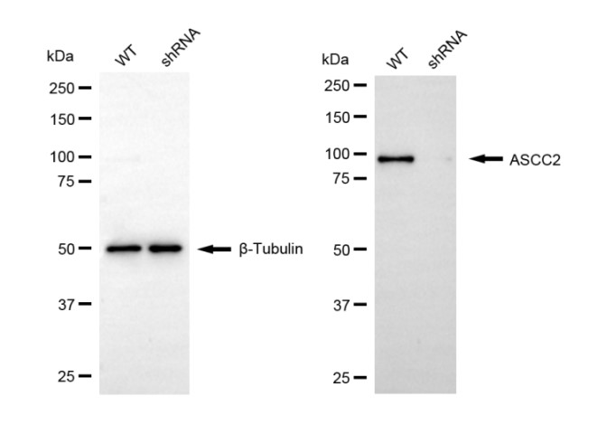 [KD Validated] Anti-ASCC2 Mouse mAb [99D98O98]