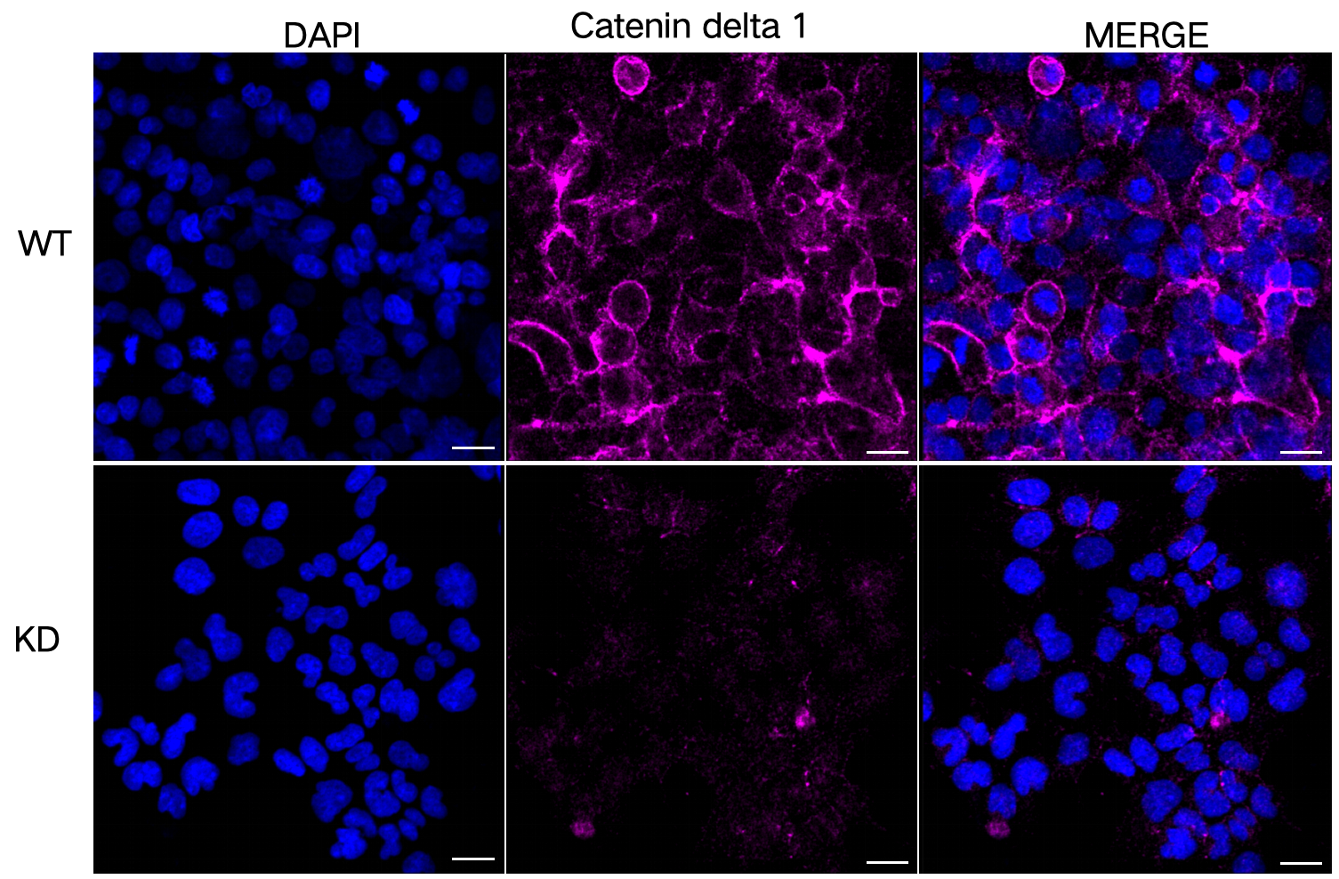[KD Validated] Anti-CTNND1 Mouse mAb [10B71N98]