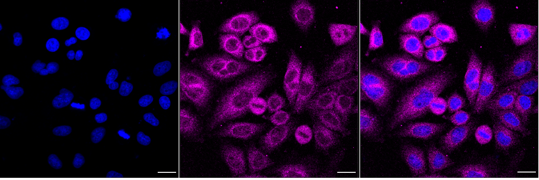 [KD Validated] Anti-NFKBIA Mouse mAb [60R55O67]