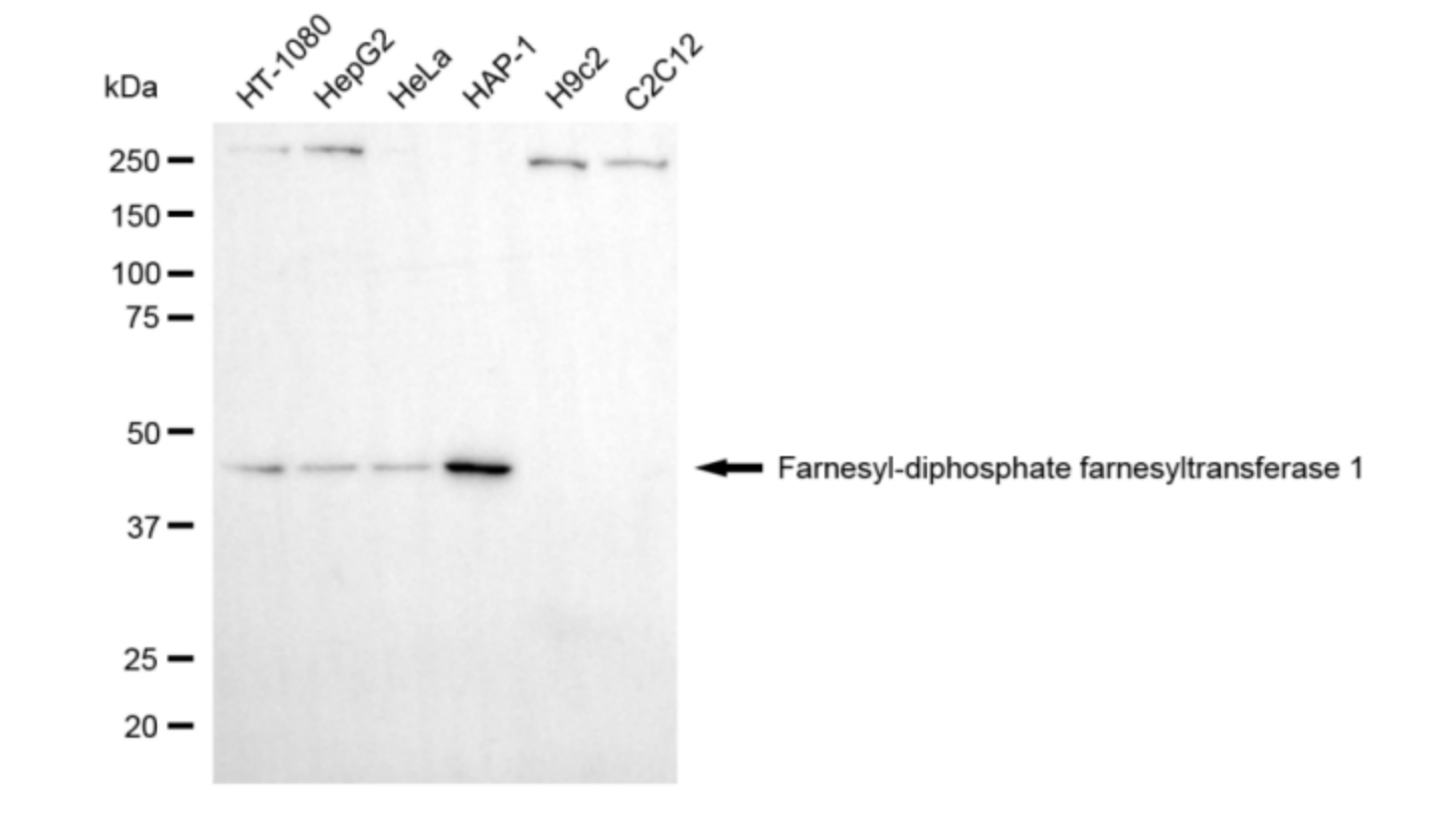 [KD Validated] Anti-FDFT1 Mouse mAb [99R79K72]