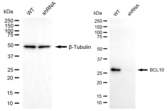[KD Validated] Anti-BCL10 Mouse mAb [63K39K94]
