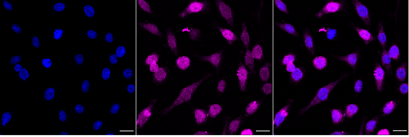 [KD Validated] Anti-MITF Mouse mAb [92Q55H79]