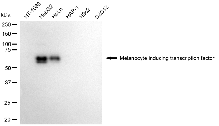 [KD Validated] Anti-MITF Mouse mAb [92Q55H79]
