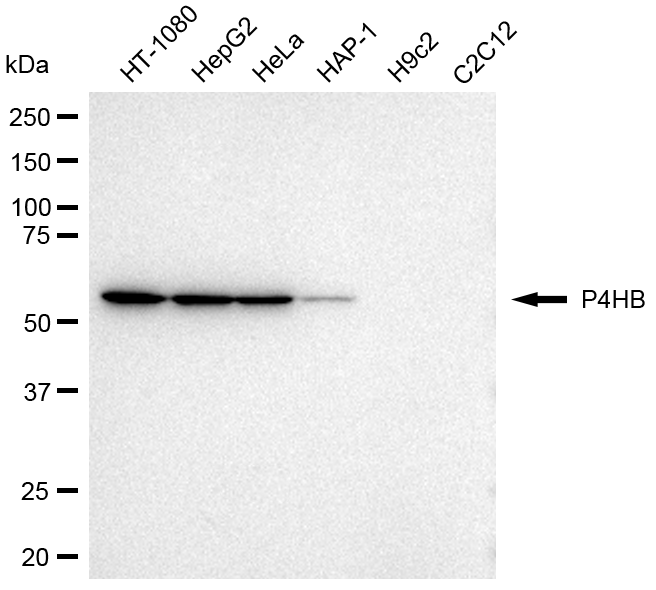 [KD Validated] Anti-P4HB Mouse mAb [54Q37R49]