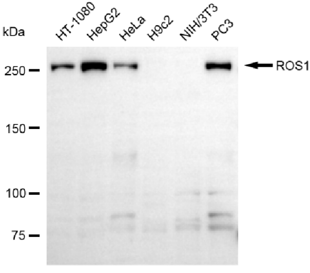 [KD Validated] Anti-ROS1 Mouse mAb [30C80S56]