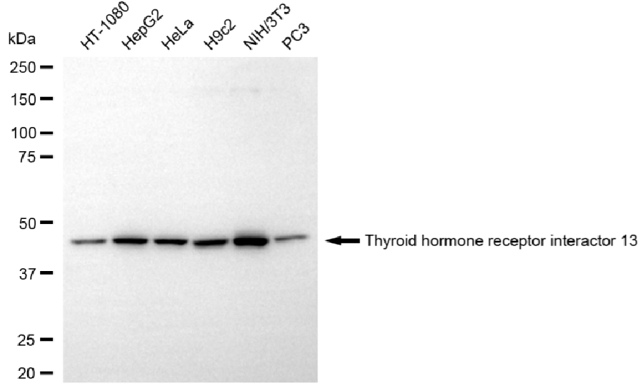 [KD Validated] Anti-TRIP13 Mouse mAb [31T74N63]