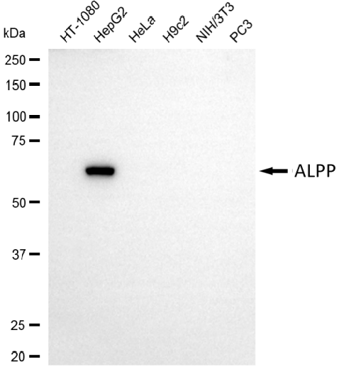 [KD Validated] Anti-ALPP Mouse mAb [57S04Q59]