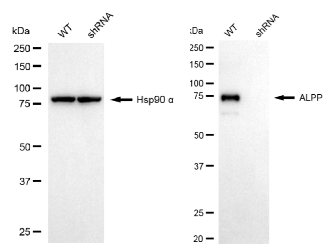 [KD Validated] Anti-ALPP Mouse mAb [57S04Q59]