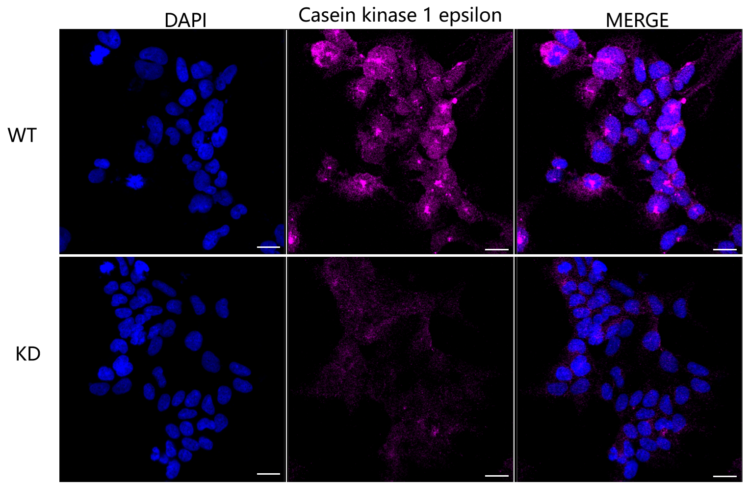 [KD Validated] Anti-CSNK1E Mouse mAb [76E99G25]