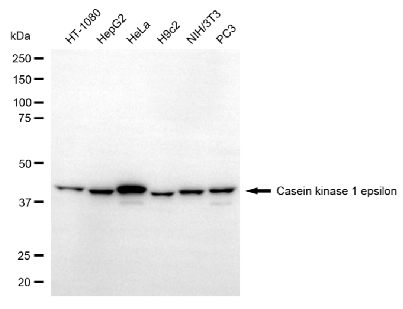 [KD Validated] Anti-CSNK1E Mouse mAb [76E99G25]
