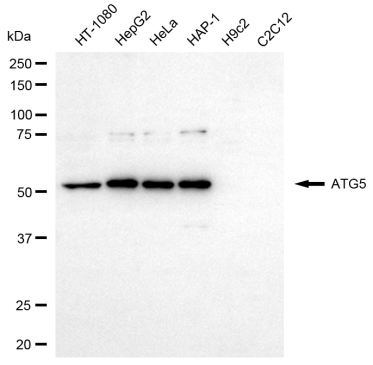 [KD Validated] Anti-ATG5 Rabbit pAb