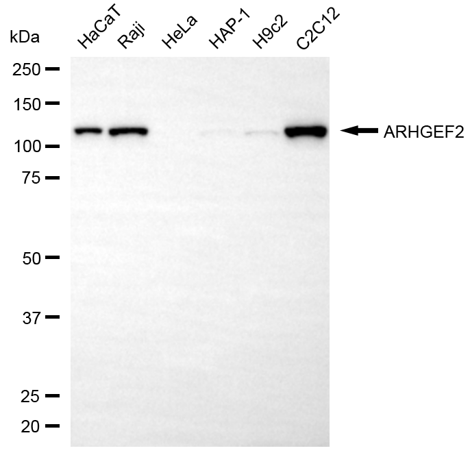 [KD Validated] Anti-ARHGEF2 Rabbit pAb