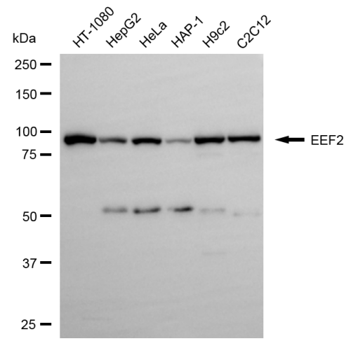[KD Validated] Anti-EEF2 Rabbit pAb