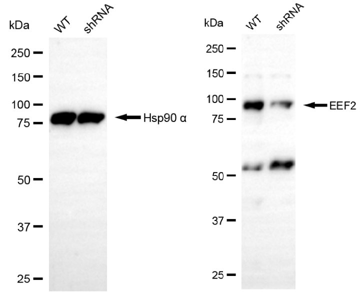 [KD Validated] Anti-EEF2 Rabbit pAb