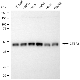 [KD Validated] Anti-CTBP2 Rabbit pAb