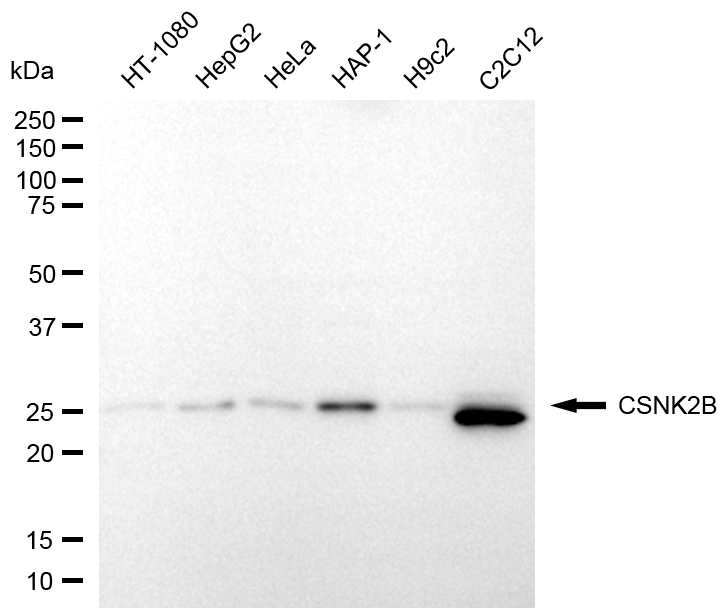 [KD Validated] Anti-CSNK2B Rabbit pAb