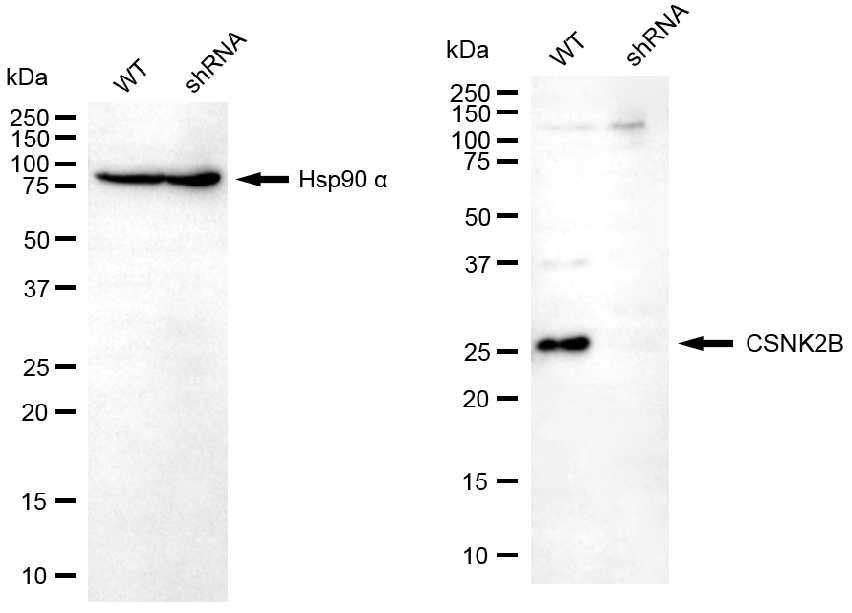 [KD Validated] Anti-CSNK2B Rabbit pAb