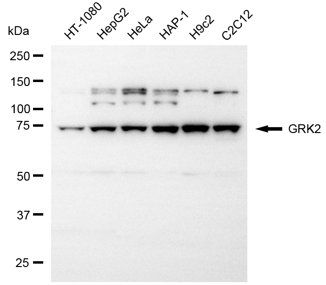 [KD Validated] Anti-GRK2 Rabbit pAb
