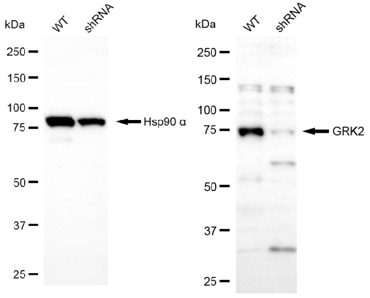 [KD Validated] Anti-GRK2 Rabbit pAb