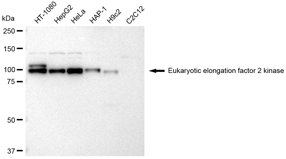 [KD Validated] Anti-EEF2K Rabbit pAb