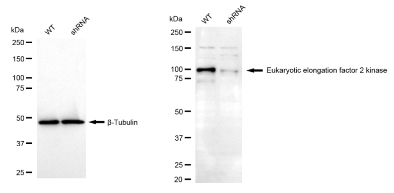 [KD Validated] Anti-EEF2K Rabbit pAb