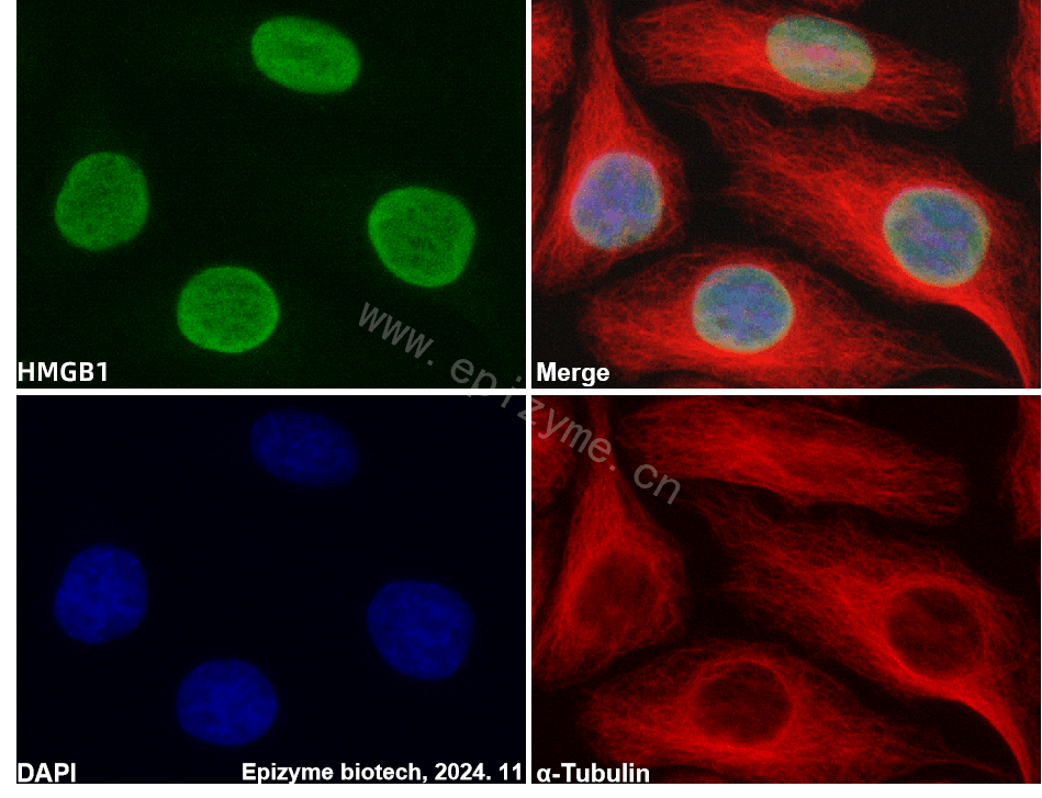 Anti-HMGB1 Rabbit mAb [20M98D47]