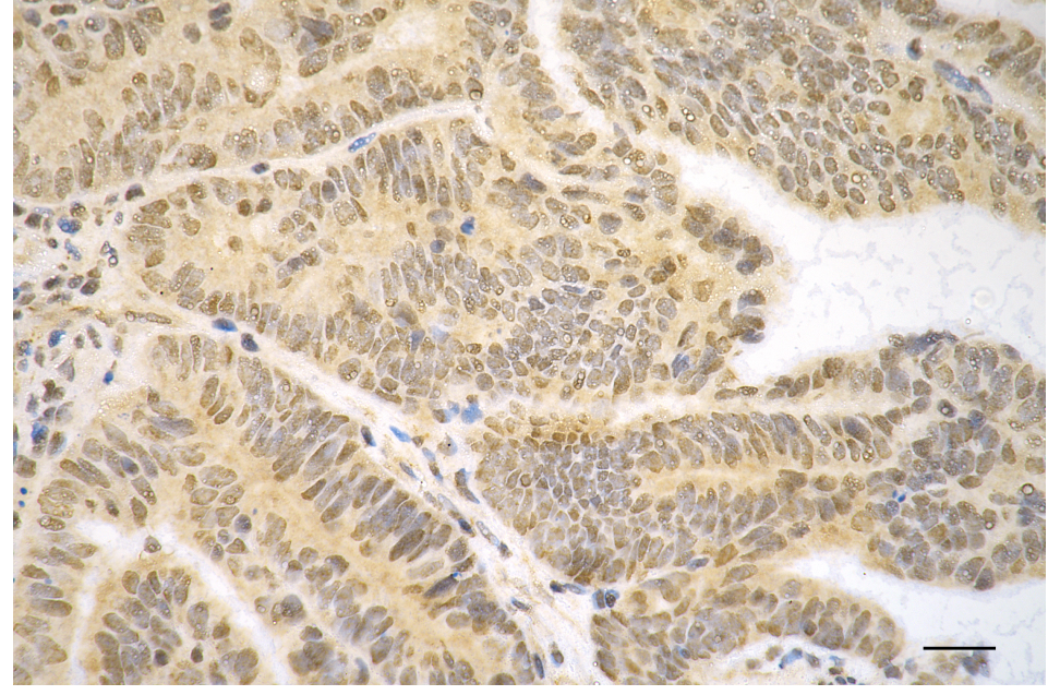 [KO Validated] Anti-GSDMD Rabbit mAb [34L45K62]
