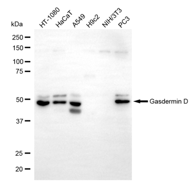 [KO Validated] Anti-GSDMD Rabbit mAb [34L45K62]