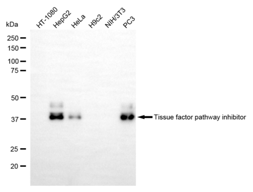 [KD Validated] Anti-TFPI Rabbit mAb [98A48S06]