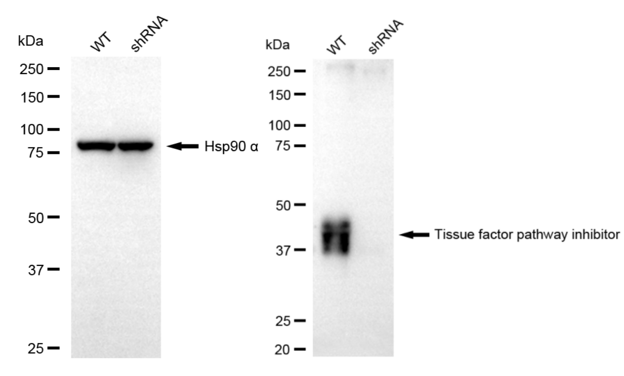 [KD Validated] Anti-TFPI Rabbit mAb [98A48S06]