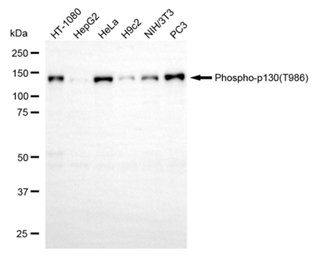 [KD Validated] Anti-RBL2 Rabbit mAb [77S24D95]