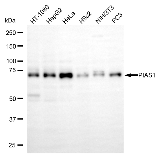 [KD Validated] Anti-PIAS1 Rabbit mAb [12G79N18]