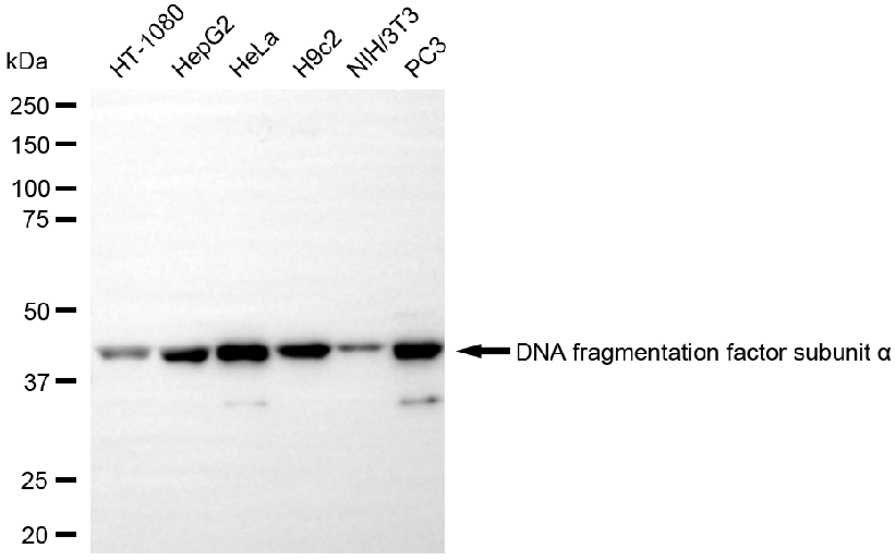 [KD Validated] Anti-DFFA Rabbit mAb [52H79H34]