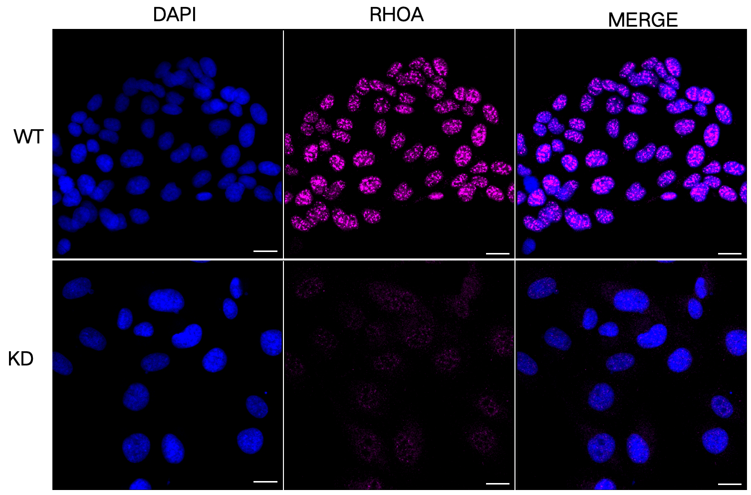 [KD Validated] Anti-RHOA Rabbit mAb [27N85J50]