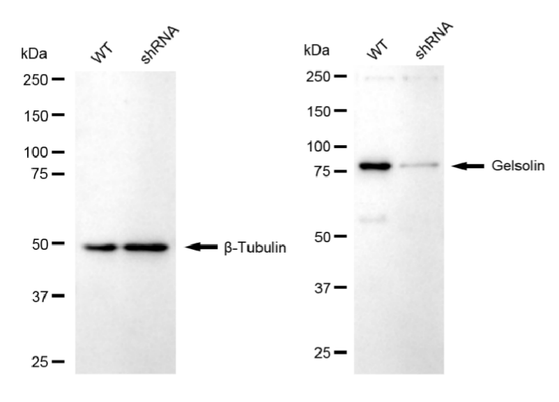 [KD Validated] Anti-GSN Rabbit mAb [67S58K70]