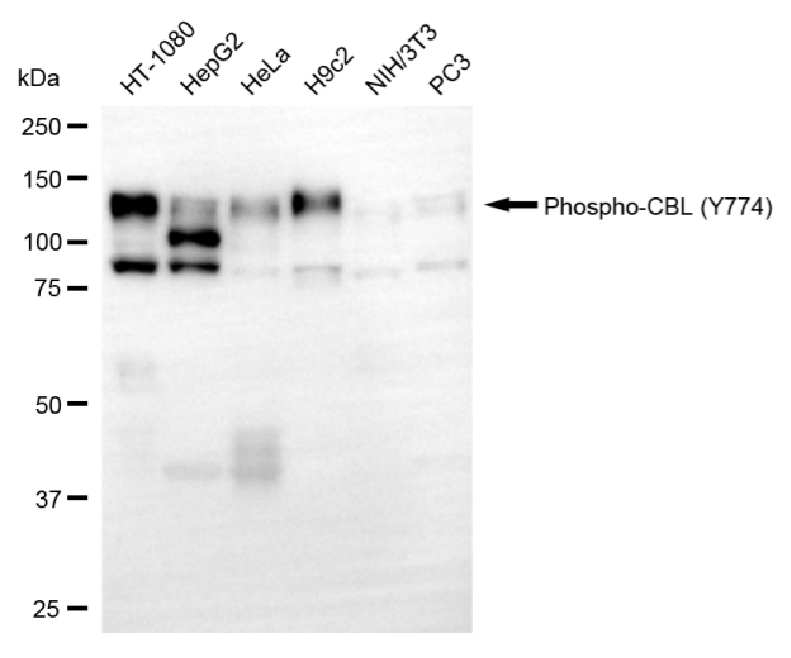 [KD Validated] Anti-CBL Rabbit mAb [34H25O90]