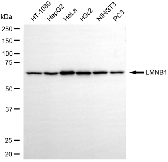 [KD Validated] Anti-LMNB1 Rabbit mAb [94B91M23]