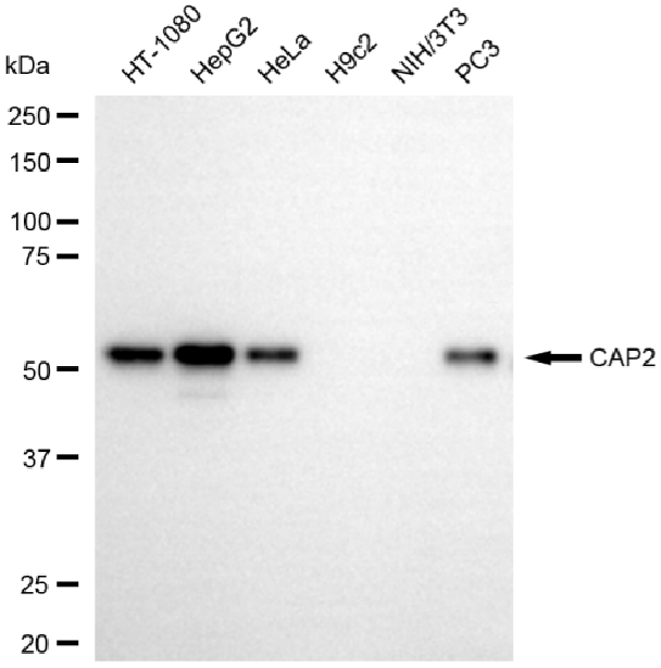 [KD Validated] Anti-CAP2 Rabbit mAb [75L44D60]