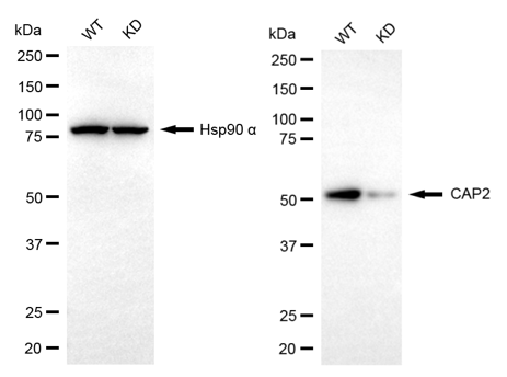 [KD Validated] Anti-CAP2 Rabbit mAb [75L44D60]