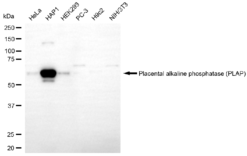 [KO Validated] Anti-ALPP Rabbit mAb [75Q92S39]