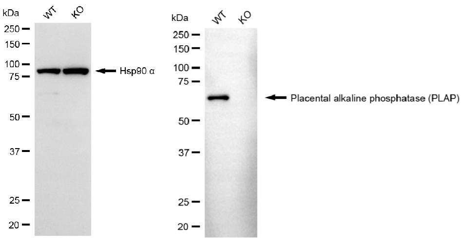 [KO Validated] Anti-ALPP Rabbit mAb [75Q92S39]